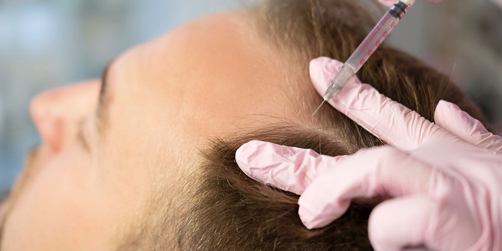 Treatments aim to stimulate hair growth, improve hair quality, and address various forms of hair loss. Combination of advanced techniques, including PRP therapy, mesotherapy, and specialized hair boosters to nourish hair follicles and promote healthy hair growth. Improved hair density, thickness, and overall hair quality. Results typically become noticeable after 2-3 months of consistent treatment.