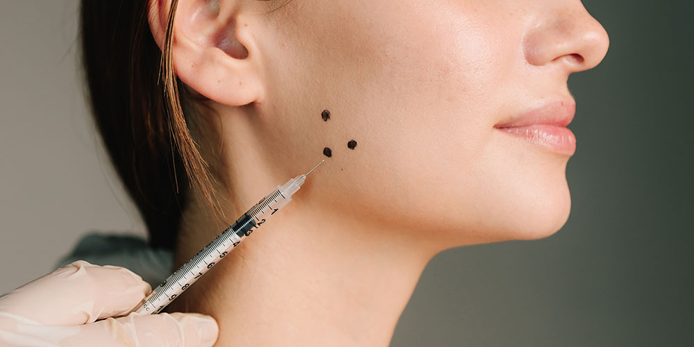 Non-invasive solutions for teeth grinding and jaw clenching, helping to alleviate pain and prevent dental damage. Primary treatment involves Botulinum toxin injections into the masseter muscles to reduce their strength and frequency of contraction. Reduced jaw tension, decreased frequency and intensity of grinding, and relief from associated headaches and facial pain.